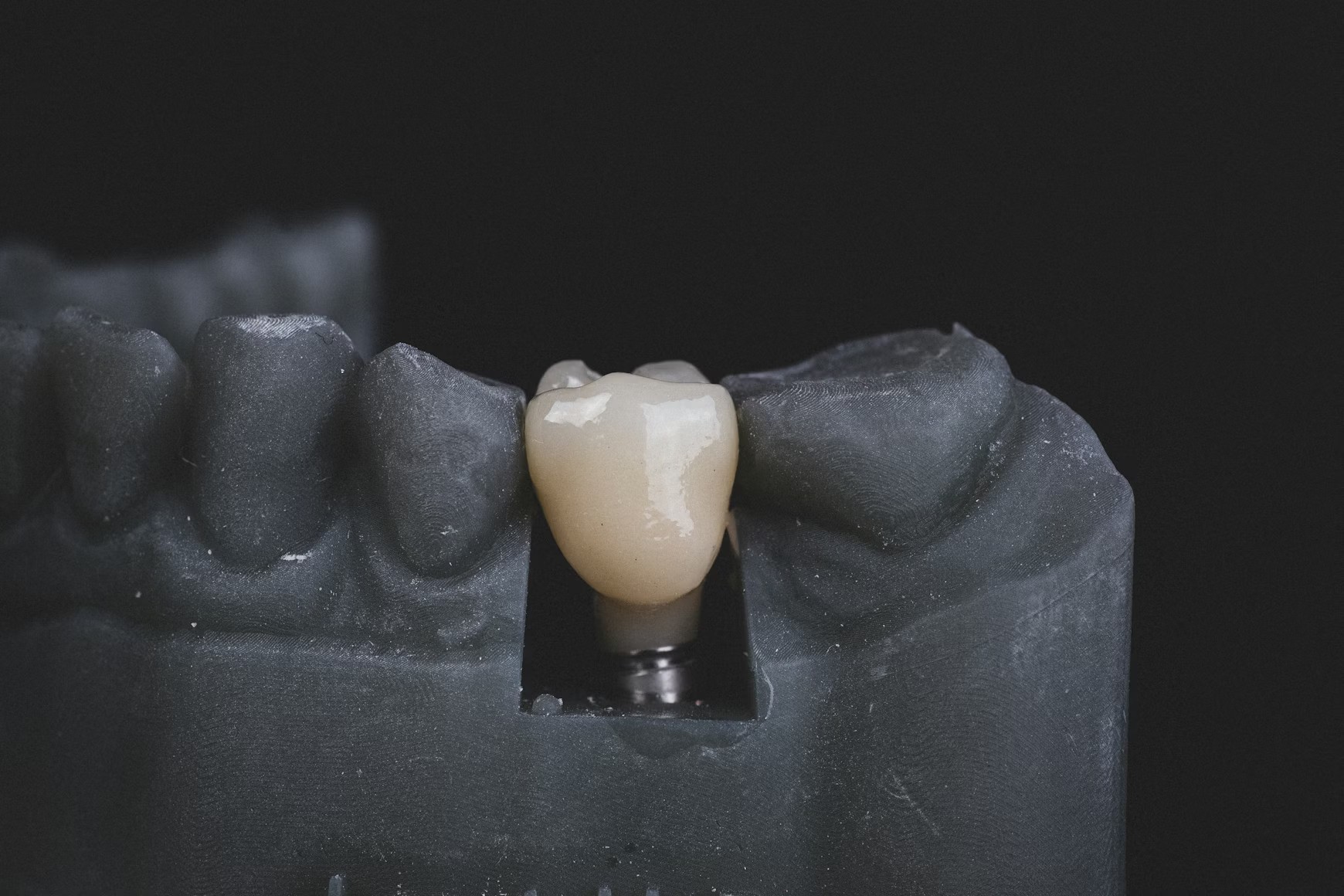 Interior moderno de clínica dental Dental Olympus con equipamiento de última generación