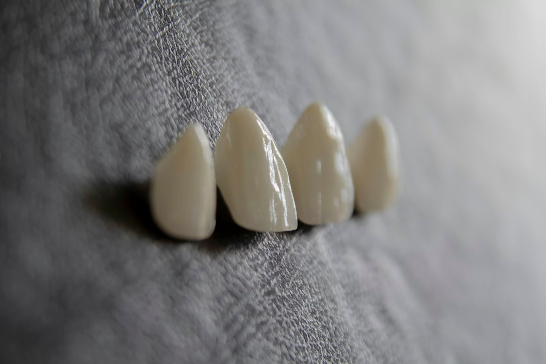 Resultado de ortodoncia invisible con alineadores transparentes